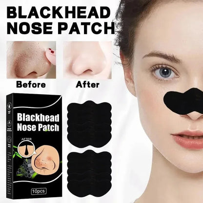 Blackhead Remover Nose Strips – Deep Pore Cleansing & Acne Treatment - Yusra Cart