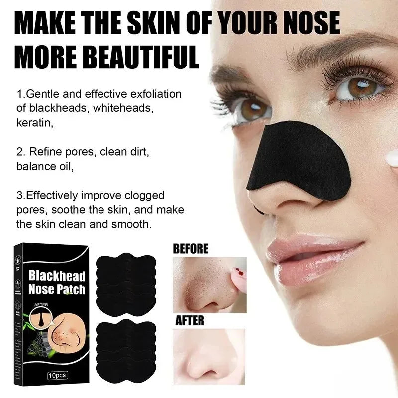 Blackhead Remover Nose Strips – Deep Pore Cleansing & Acne Treatment - Yusra Cart