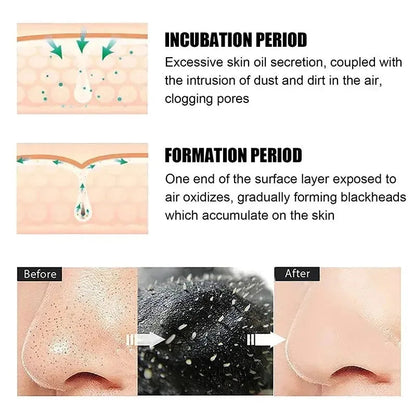 Blackhead Remover Nose Strips – Deep Pore Cleansing & Acne Treatment - Yusra Cart