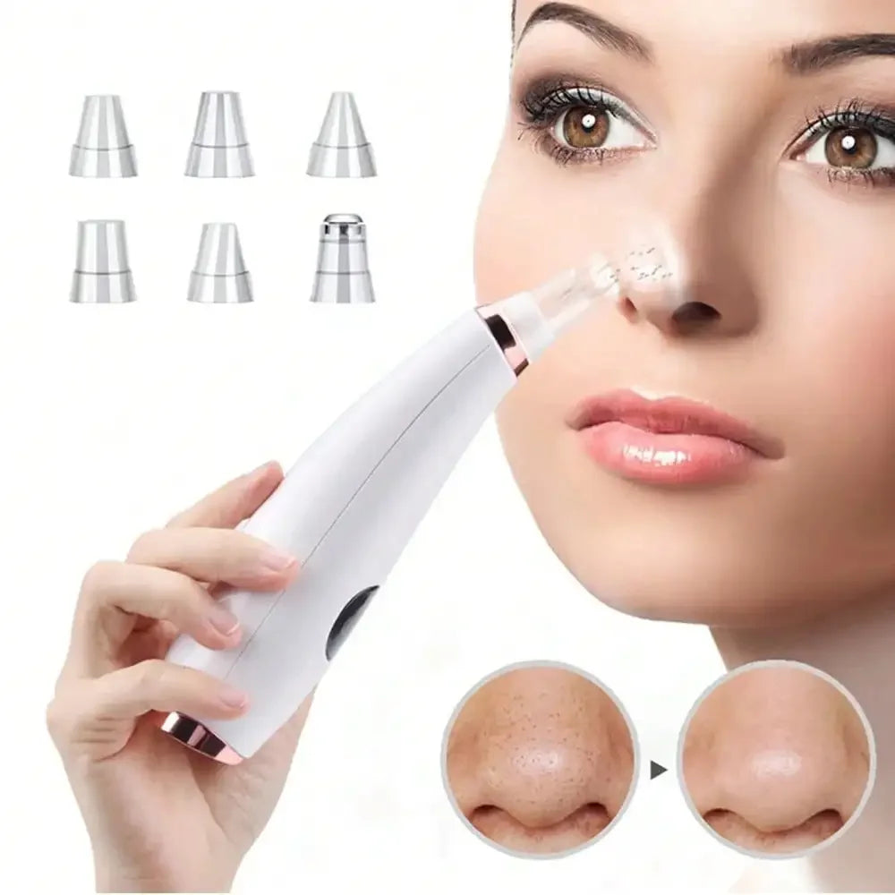 Blackhead Remover Vacuum – Electric Pore Cleaner & Acne Removal Tool - Yusra Cart